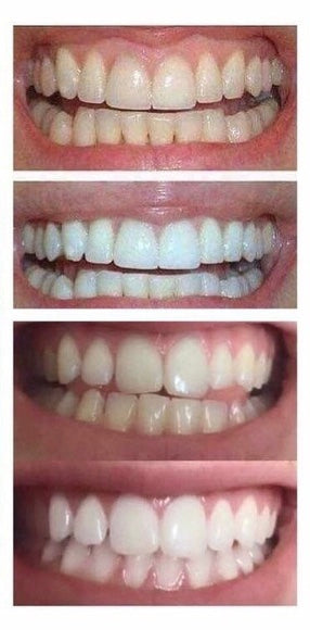 AP 24 Whitening Fluoride Toothpaste - Roseabella 